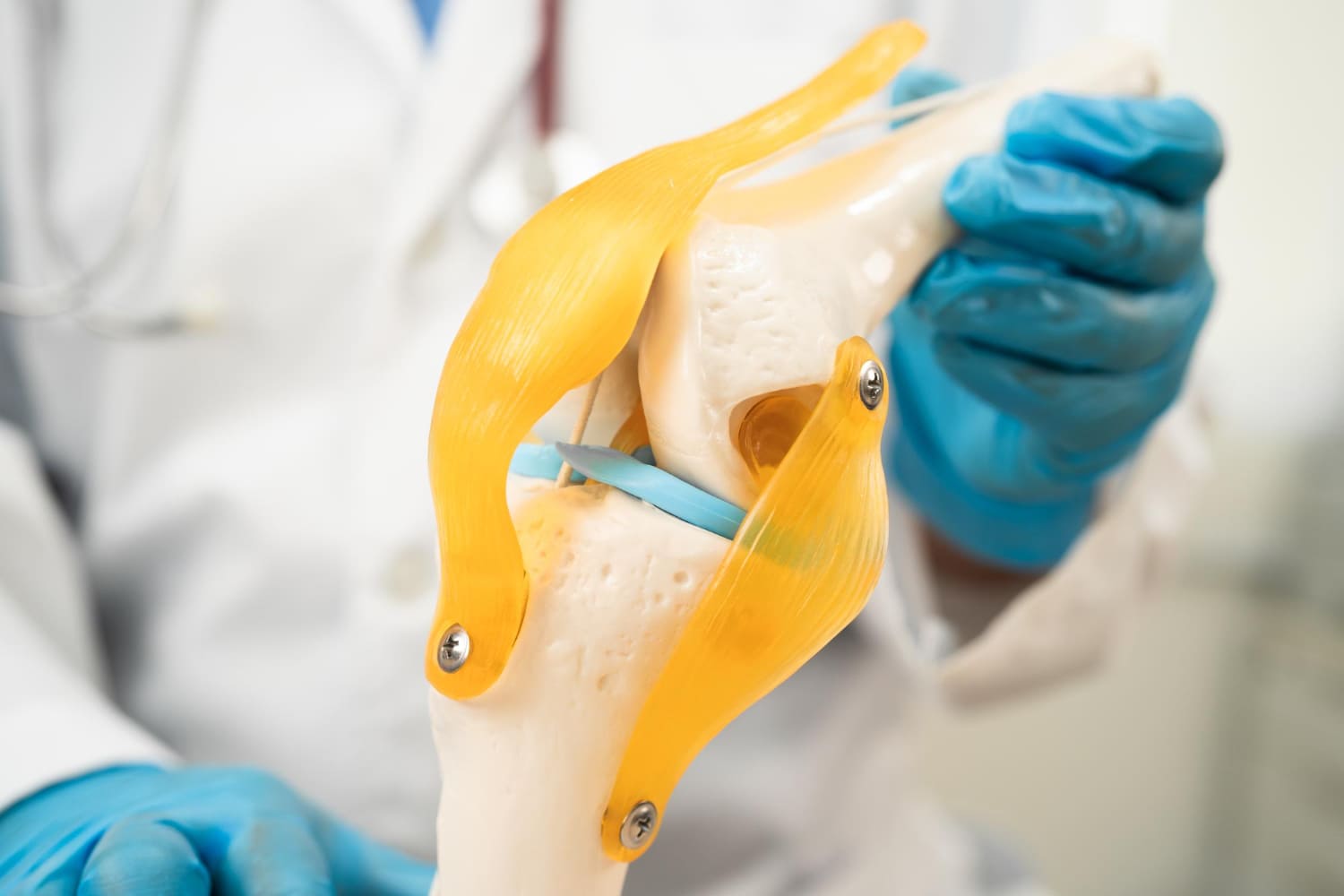 Artroscopia de rodilla